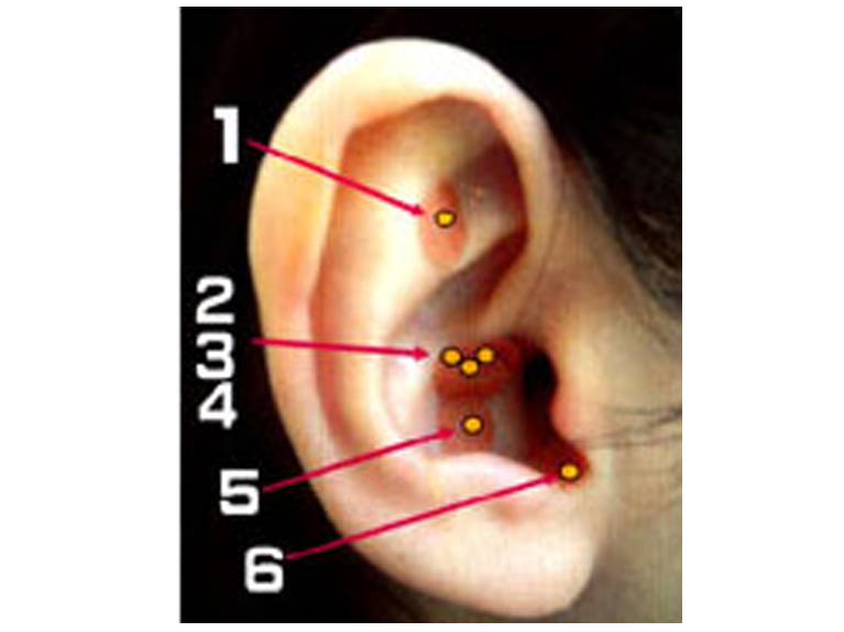 耳つぼダイエットコース