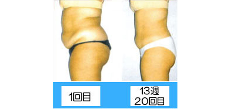 エンダモロジー