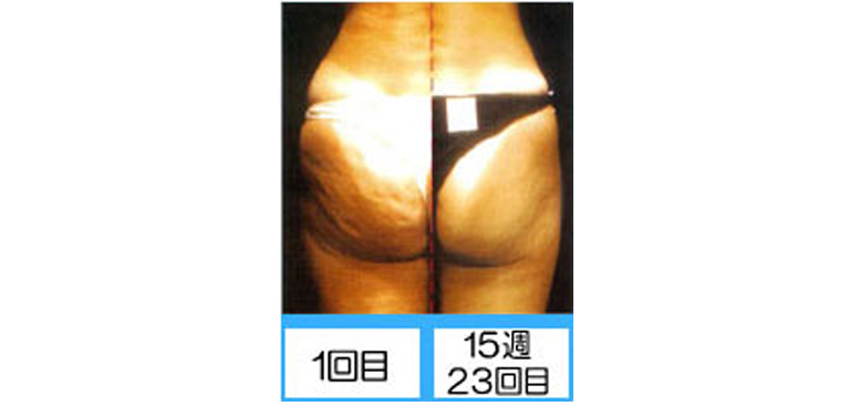 エンダモロジー