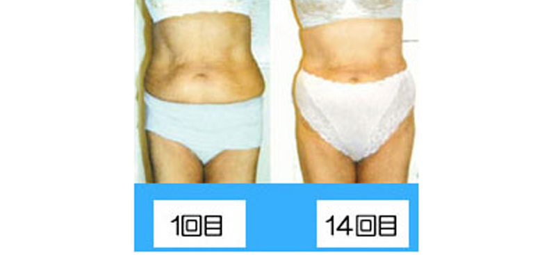 エンダモロジー